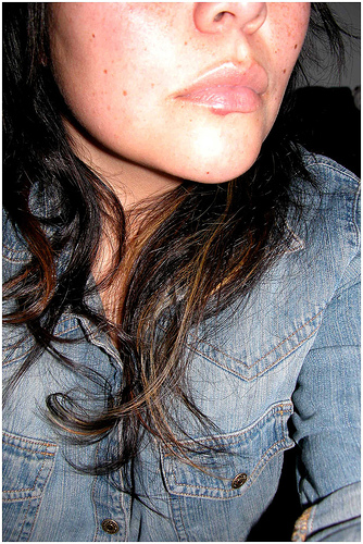 lip blister girl with a cold sore or lip blister