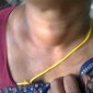 Home Remedies For Treating Thyroid Problems