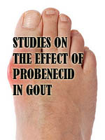 STUDIES ON THE EFFECT OF PROBENECID IN GOUT