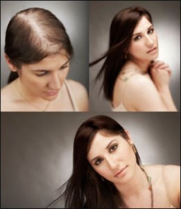 3-stages-of-hair-growth 3-stages-of-hair-growth