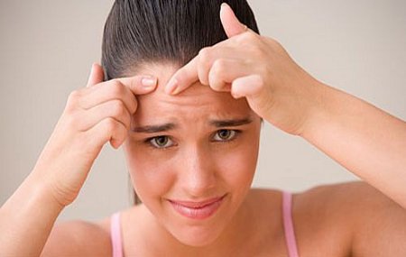 forehead pimple squeeze Girl squeezing a pimple on her forehead (not gross)