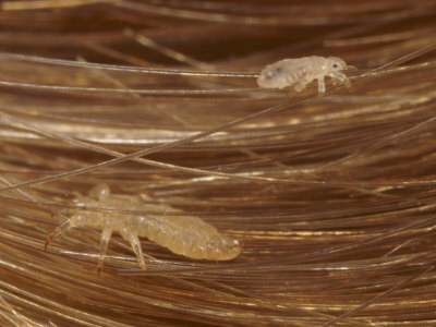head lice close up in hair