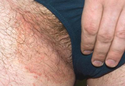 jockitch1