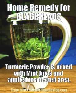home remedy for blackheads meme home remedy for blackheads - meme